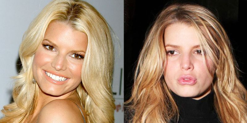 Jessica Simpson Criticized For Having Lips Done: Plastic Surgery, Trolls, And Reaction